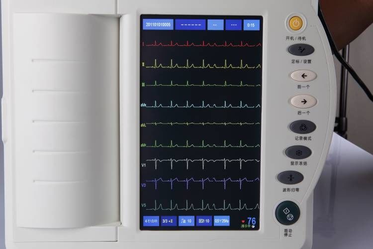 Human ecg machine heart examination cardiology 12 channel ecg machine ekg electrocardiogram machine ECG