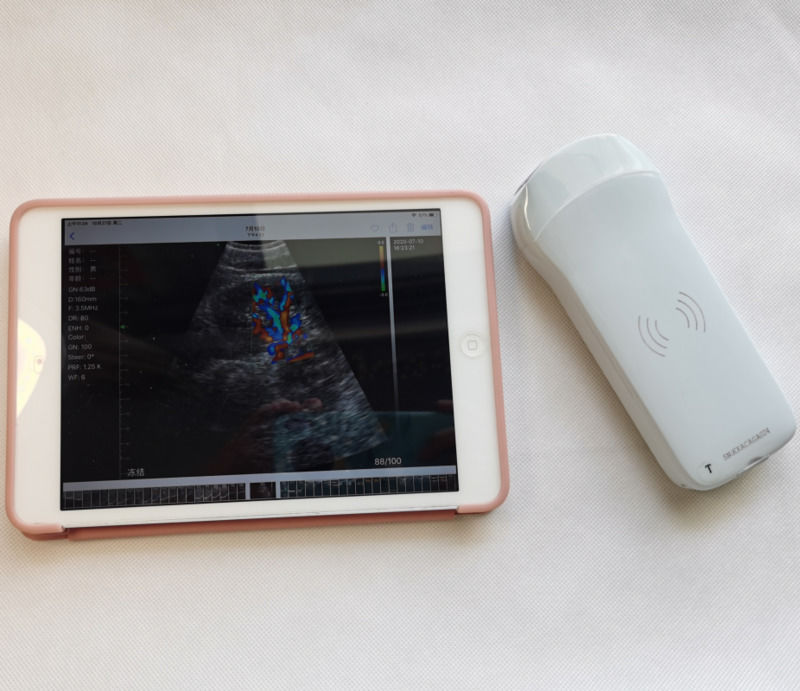 Usg New Look 3d Image GYN Image Laptop Ob Gyn Fetal Ultrasound Machine Color Doppler With High Quality