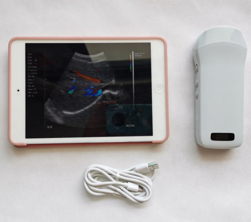 Usg New Look 3d Image GYN Image Laptop Ob Gyn Fetal Ultrasound Machine Color Doppler With High Quality