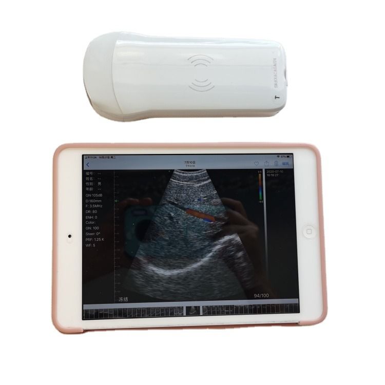 GYN High Quality Portable Veterinary Fast Delivery 3d Daignosis Medical Horse Ultrasound Machine For Cow