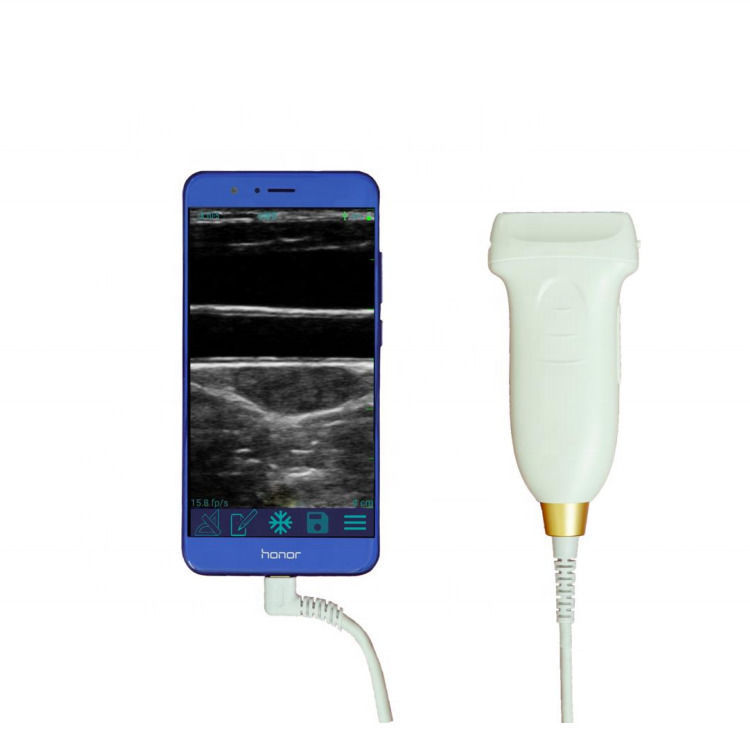 GYN Ultrasound Probe 3 in 1 usb wifi convex ultrasound wireless probes for android