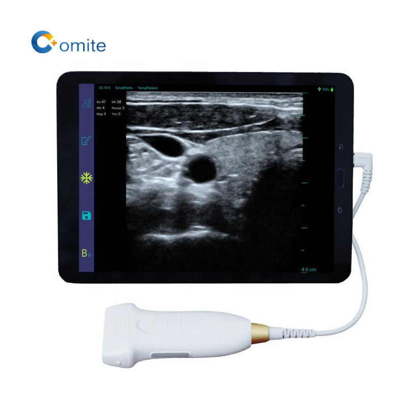 GYN Ultrasound Probe 3 in 1 usb wifi convex ultrasound wireless probes for android