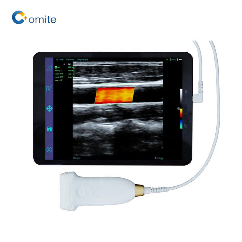 GYN ultrasound probe convex wifi usb wireless ultrasound probes for android