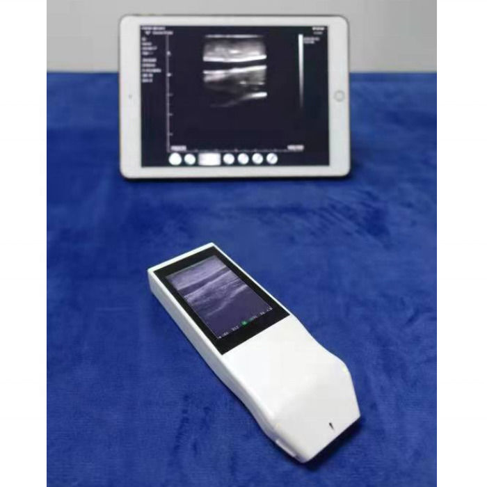 WIFI Wireless Color Probe GYN Ultrasound Linear Probe With Display Anesthesia Puncture Navigation Handheld Ultrasound