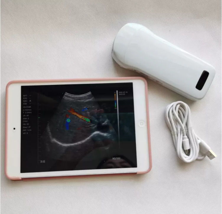 GYN Ultrasound Instruments Wireless Portable Clinical Probe Analytical Instruments Mobile Ultrasound Machine