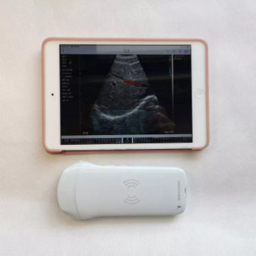 GYN Ultrasound Instruments Wireless Portable Clinical Probe Analytical Instruments Mobile Ultrasound Machine