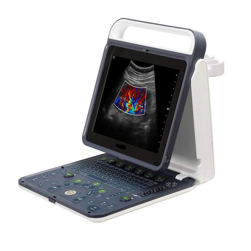Hospital Outside 2020 New Portable Digital 15 Inch Color Doppler Ultrasound Machine