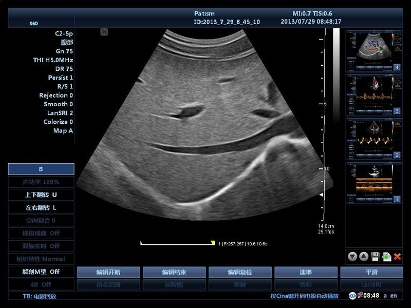 Hospital Outside Trolley 15Inch Ultrasound Machine Ultrasound Digital Color Doppler Ultrasound Machines edical