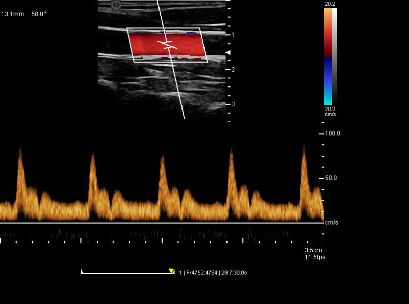 China Cart Digital Color Doppler Ultrasound Medical Ultrasound Machine Ultrasound Hospital Outside