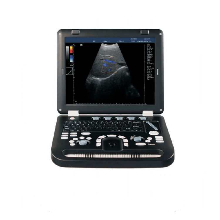 100% Guaranteed Portable Color Doppler Ultrasound Echocardiography Echo Ultrasound Machine