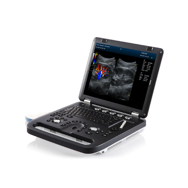 100% Guaranteed Portable Color Doppler Ultrasound Echocardiography Echo Ultrasound Machine