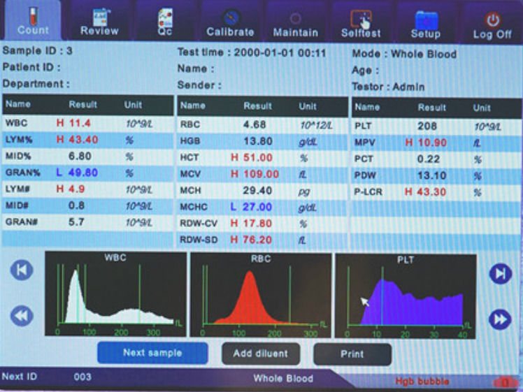 Clinical Analytical Fully Automatic Hematology Instruments Blood Cell Analyzer Comite Plus Fully Automatic Hematology Analyzer CMT-800