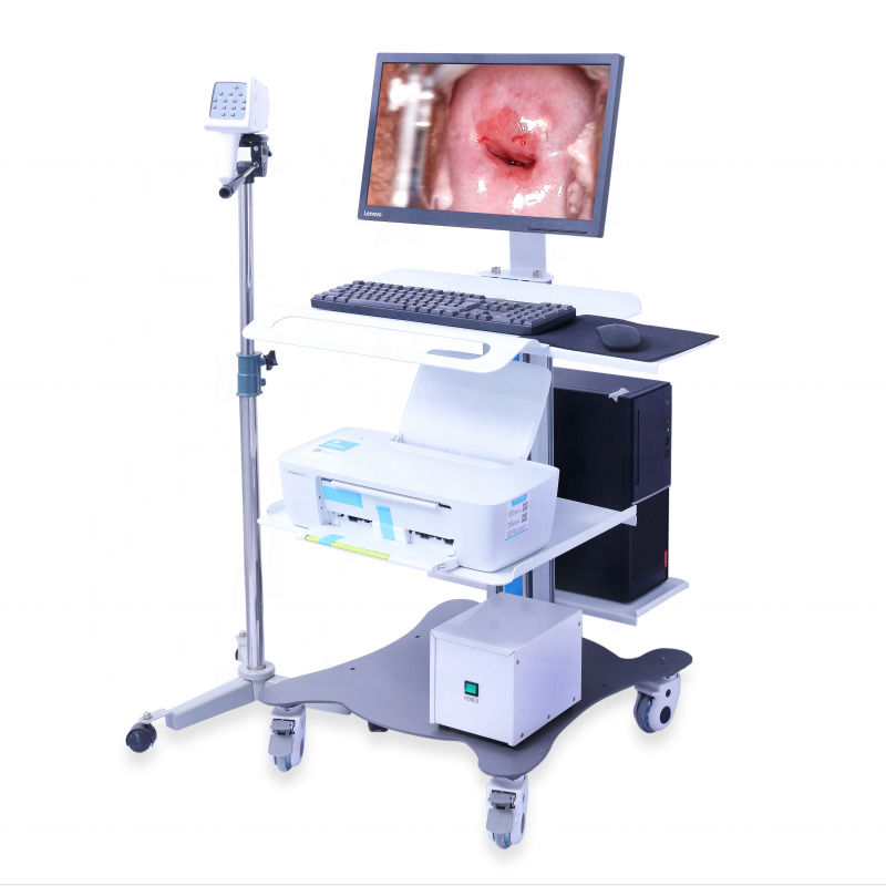 Portable GYN Colposcope Digital Colposcope Imaging System Vagina Examination Video Colposcope For Gynecology