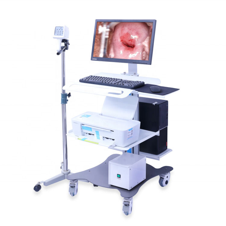 Portable GYN Colposcope Digital Colposcope Imaging System Vagina Examination Video Colposcope For Gynecology