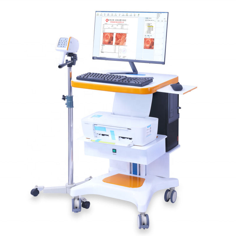 Portable GYN Colposcope Full Hd Sony Camera Digital Video Colposcope Imaging System Examination Colposcope For Gynecology